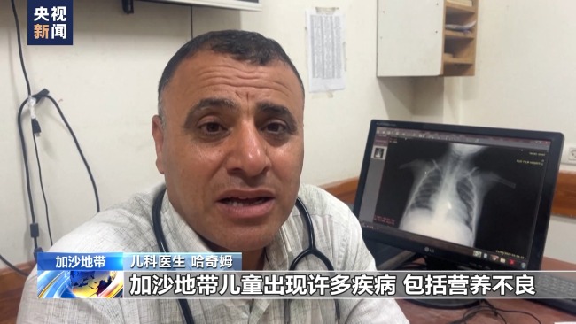 食物及药品短缺 加沙儿童面临健康风险-图3